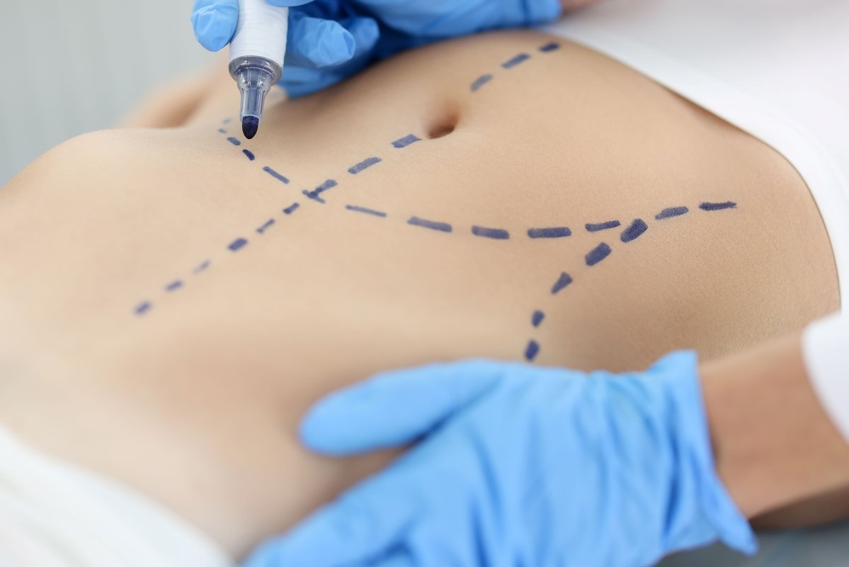 Cirurgia plástica: busca por resultados naturais é tendência