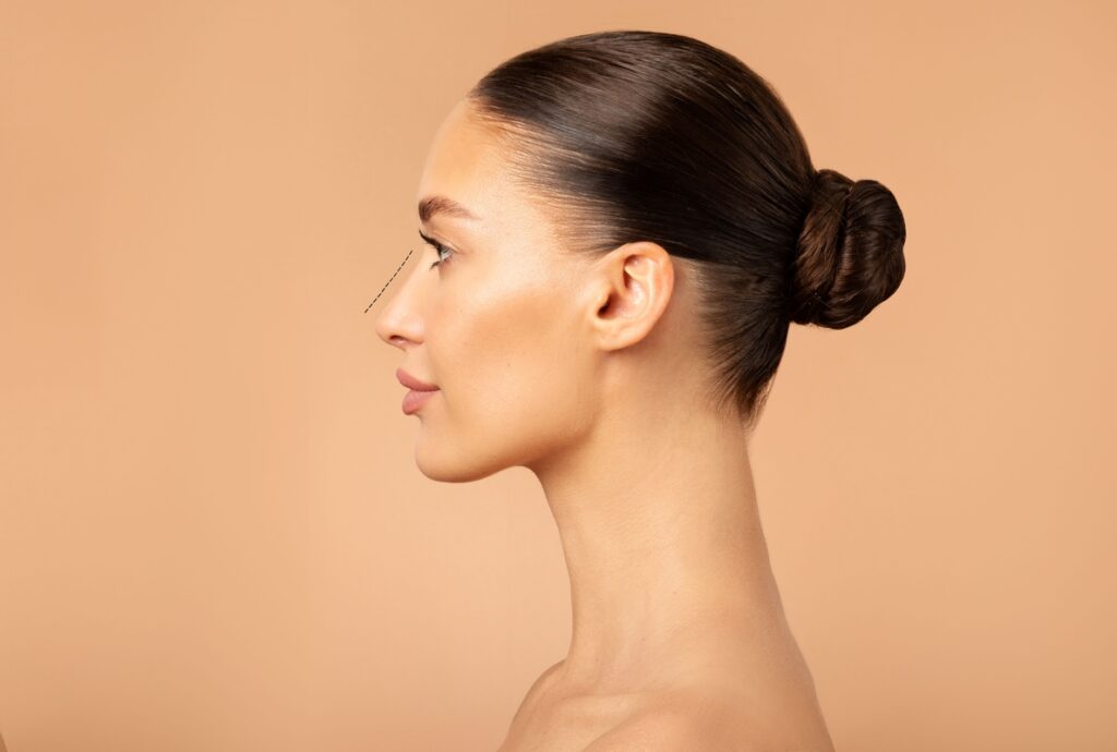 Rinoplastia ultrassônica gera avanços na estética facial